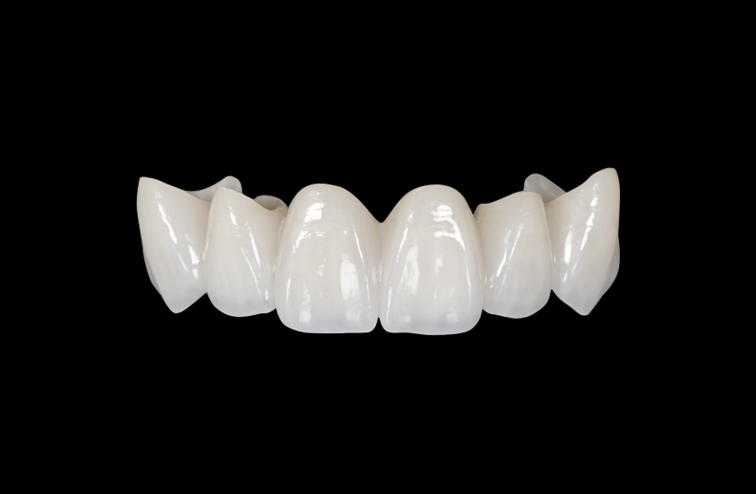 Hybrid Zirconia